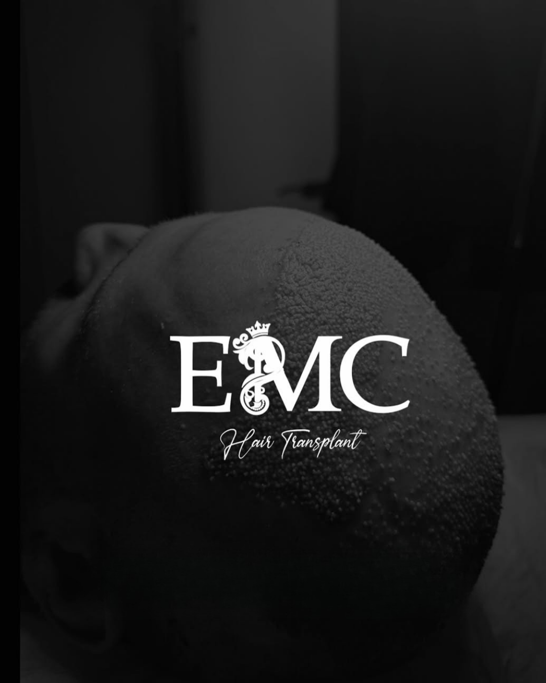 EMC Haır Aesthetıc